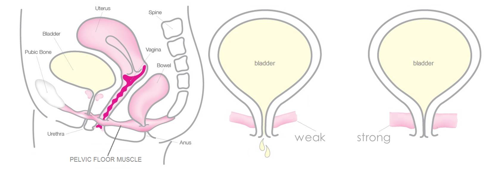 pelvic-muslce-bladder-comparison-diagram.jpg