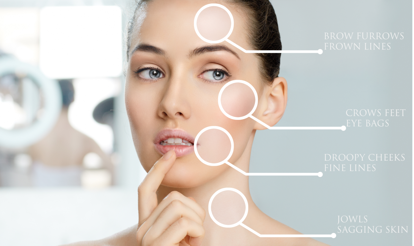 Facial Muscle Tone 70